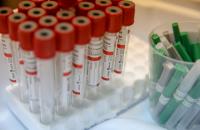 Оперштаб: 70 заболевших COVID-19 зарегистрировано в Приморье за последние сутки